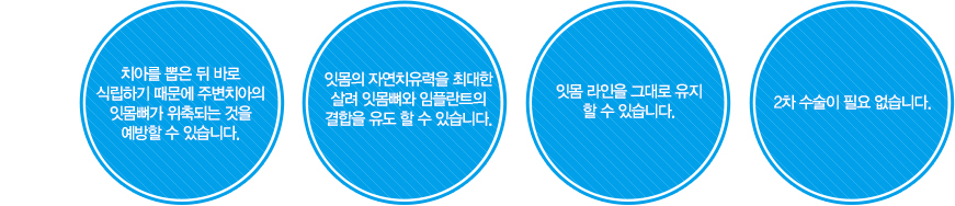 대전원데이임플란트의 장점