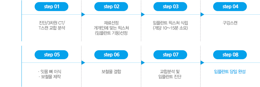 대전원데이 임플란트 수술과정