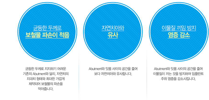 대전3D임플란트의 장점