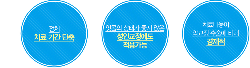 대전급속교정의장점