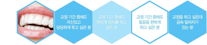 대전설측교정의 장·단점