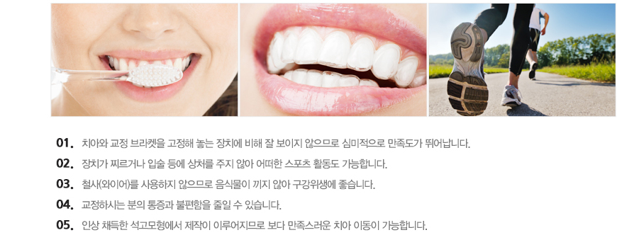 대전투명교정의 장점