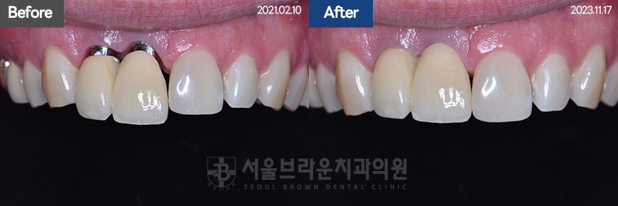 7eaaa1193f82035bebb1fa9dda3125ba_1764306