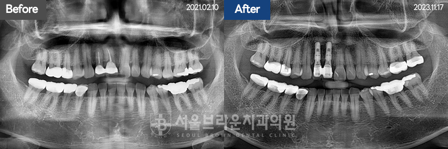 7eaaa1193f82035bebb1fa9dda3125ba_1764306