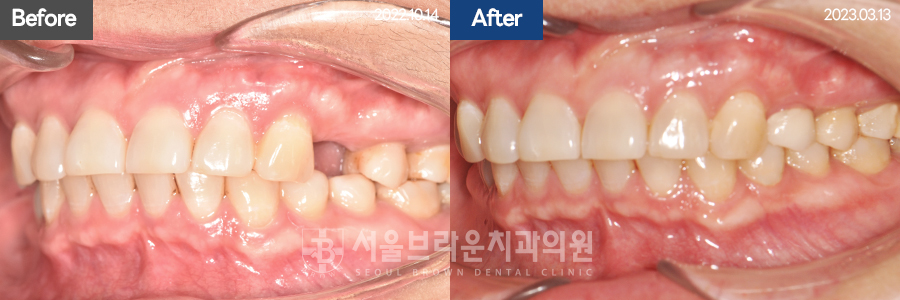 7eaaa1193f82035bebb1fa9dda3125ba_1764307