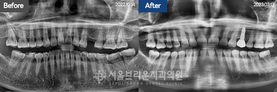 7eaaa1193f82035bebb1fa9dda3125ba_1764307