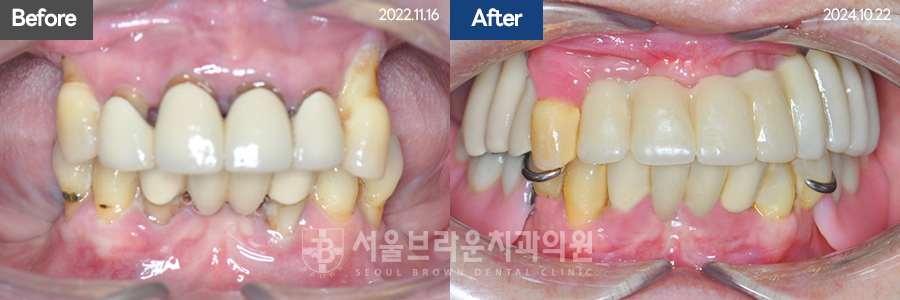 7eaaa1193f82035bebb1fa9dda3125ba_1764307