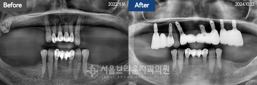 7eaaa1193f82035bebb1fa9dda3125ba_1764307