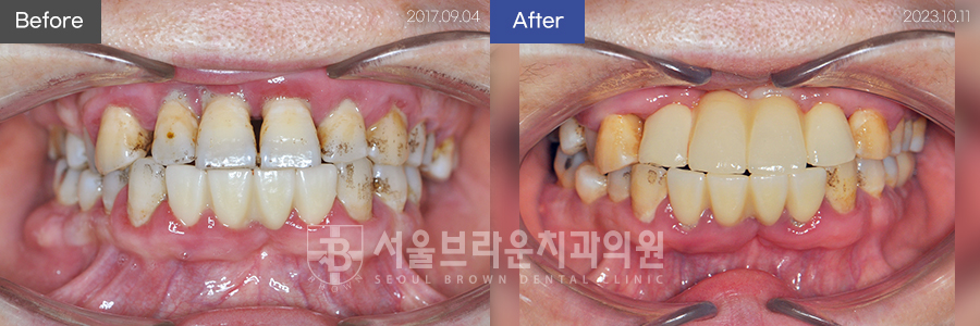 7eaaa1193f82035bebb1fa9dda3125ba_1764311