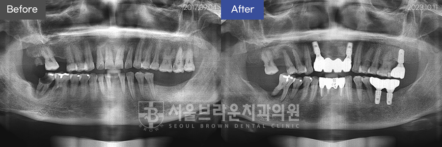 7eaaa1193f82035bebb1fa9dda3125ba_1764311