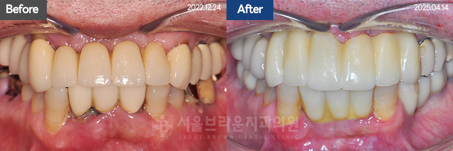 7eaaa1193f82035bebb1fa9dda3125ba_1764311