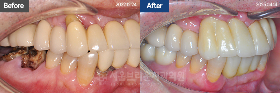 7eaaa1193f82035bebb1fa9dda3125ba_1764311