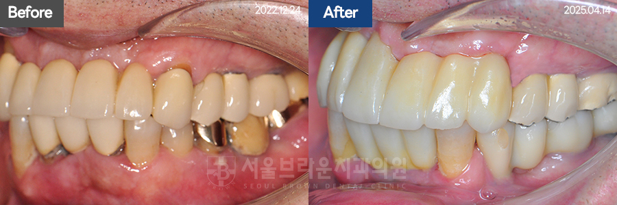 7eaaa1193f82035bebb1fa9dda3125ba_1764311