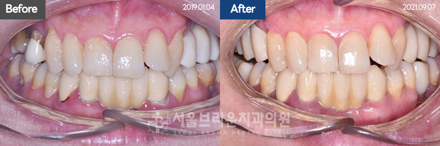 7eaaa1193f82035bebb1fa9dda3125ba_1764311