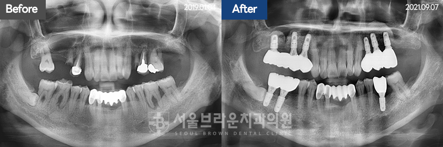 7eaaa1193f82035bebb1fa9dda3125ba_1764311