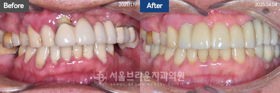 7eaaa1193f82035bebb1fa9dda3125ba_1764312