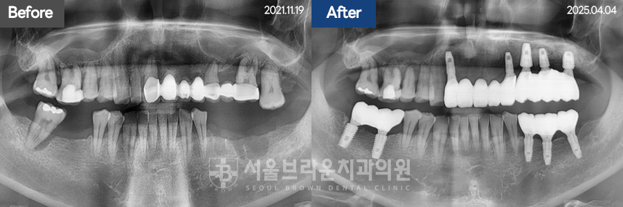 7eaaa1193f82035bebb1fa9dda3125ba_1764312