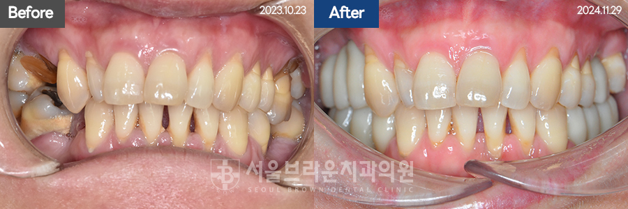 7eaaa1193f82035bebb1fa9dda3125ba_1764312