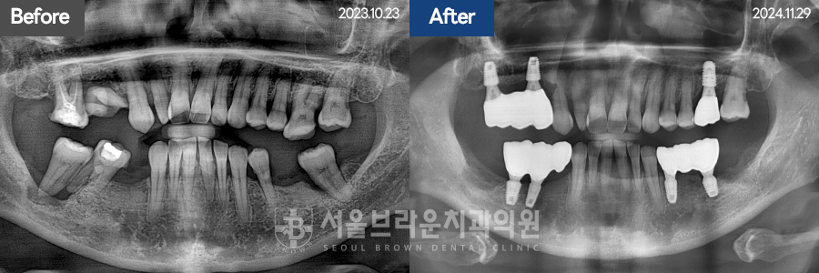 7eaaa1193f82035bebb1fa9dda3125ba_1764312