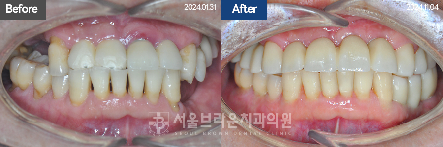 7eaaa1193f82035bebb1fa9dda3125ba_1764312