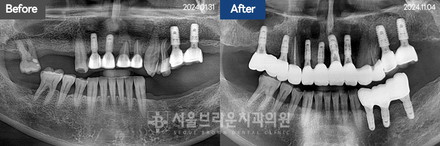 7eaaa1193f82035bebb1fa9dda3125ba_1764312