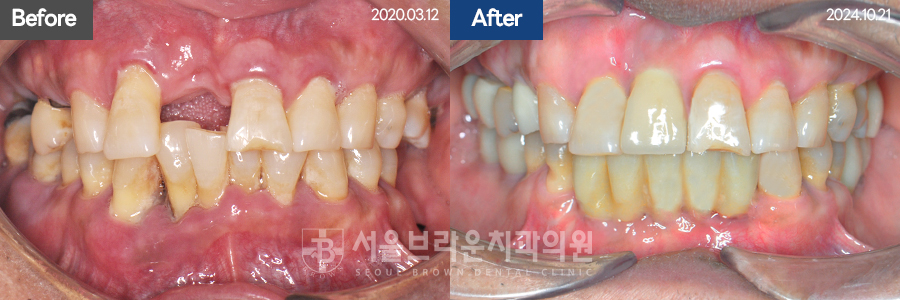 7eaaa1193f82035bebb1fa9dda3125ba_1764312