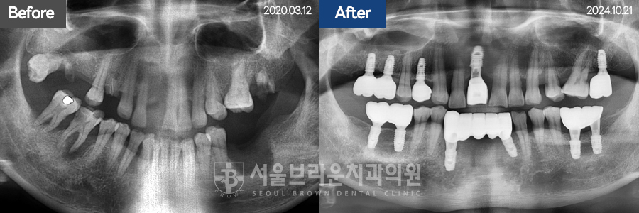 7eaaa1193f82035bebb1fa9dda3125ba_1764312