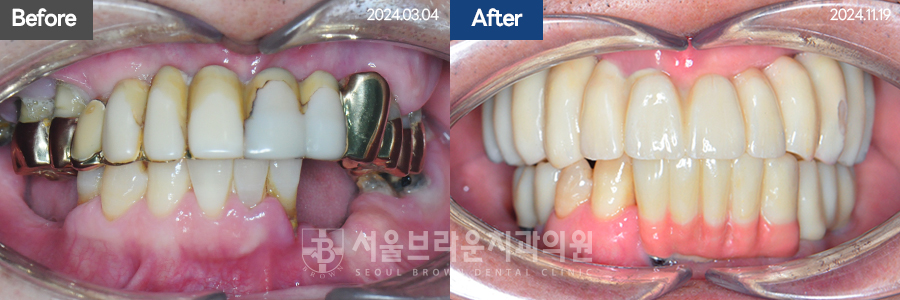 7eaaa1193f82035bebb1fa9dda3125ba_1764312