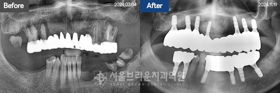 7eaaa1193f82035bebb1fa9dda3125ba_1764312