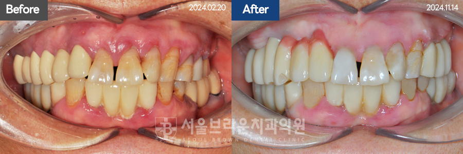 7eaaa1193f82035bebb1fa9dda3125ba_1764312