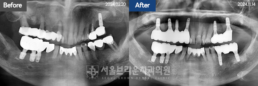 7eaaa1193f82035bebb1fa9dda3125ba_1764312