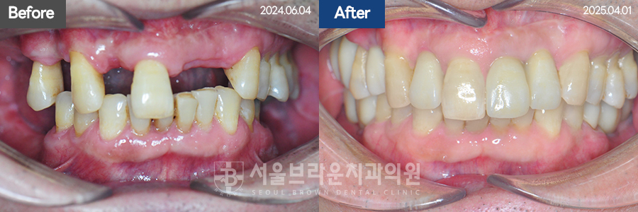 7eaaa1193f82035bebb1fa9dda3125ba_1764312