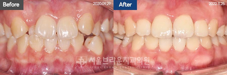 cc63330f7b4238188c5d7ef7e589b08a_1762411