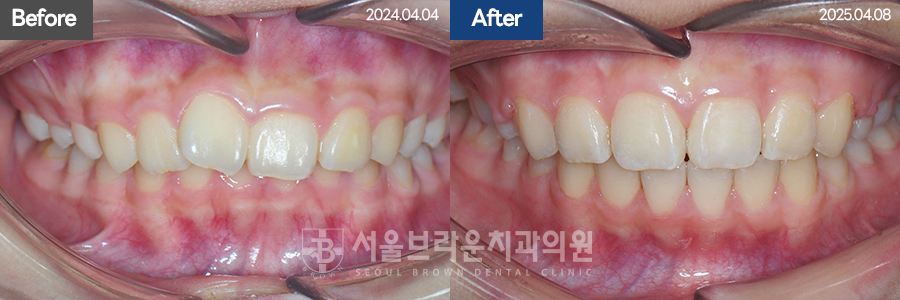 790d46d7c86c18044057d8ae3a5ad616_1766044