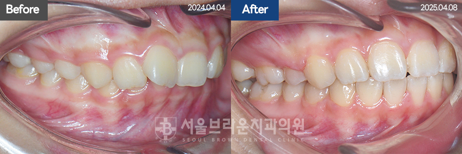 790d46d7c86c18044057d8ae3a5ad616_1766044