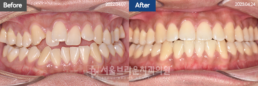 790d46d7c86c18044057d8ae3a5ad616_1766044