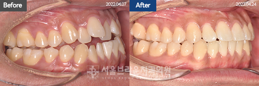 790d46d7c86c18044057d8ae3a5ad616_1766044