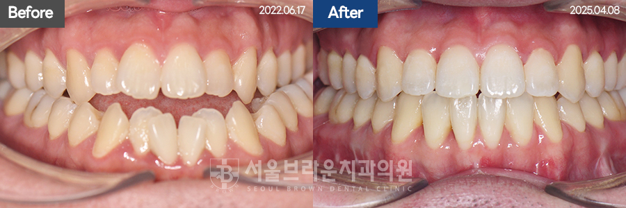 790d46d7c86c18044057d8ae3a5ad616_1766044