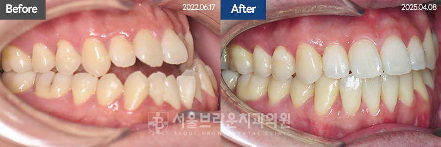 790d46d7c86c18044057d8ae3a5ad616_1766044