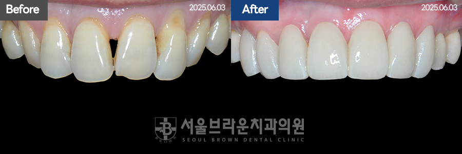 d78676efefa191e8395e376d737bc12d_1765350