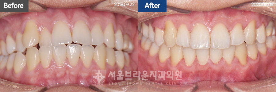 dfb807f3e80950022a62ada9b18a37a7_1767076