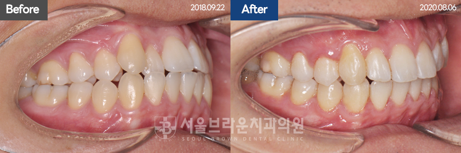 dfb807f3e80950022a62ada9b18a37a7_1767076