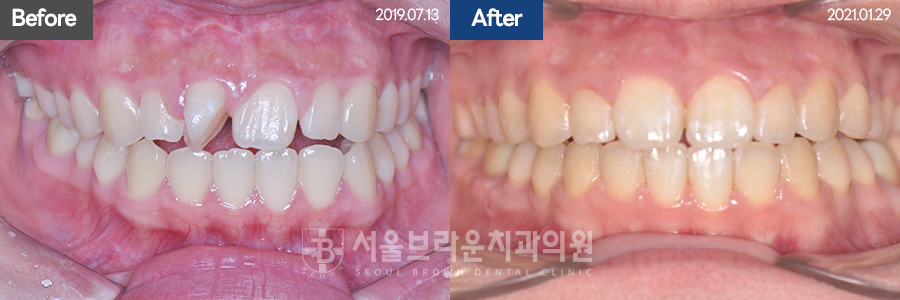 dfb807f3e80950022a62ada9b18a37a7_1767077