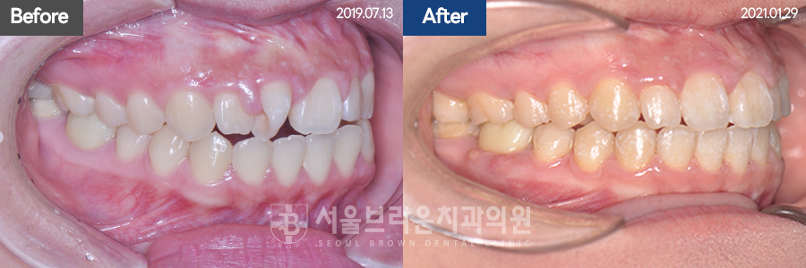 dfb807f3e80950022a62ada9b18a37a7_1767077