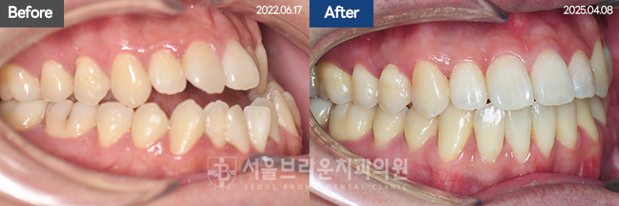 b05cd4bba924b3cd77aa7a17d37d707b_1768203