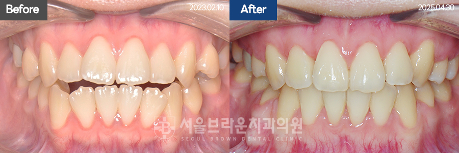 b05cd4bba924b3cd77aa7a17d37d707b_1768204