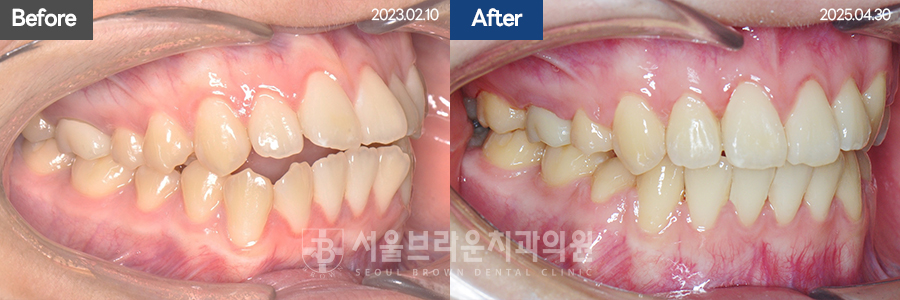 b05cd4bba924b3cd77aa7a17d37d707b_1768204