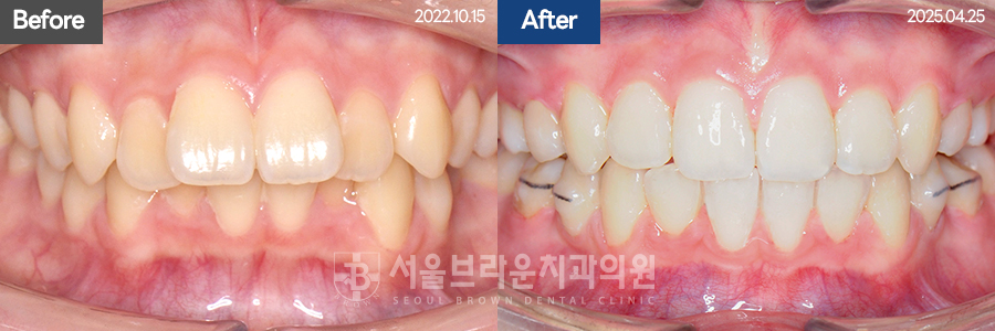 b05cd4bba924b3cd77aa7a17d37d707b_1768206