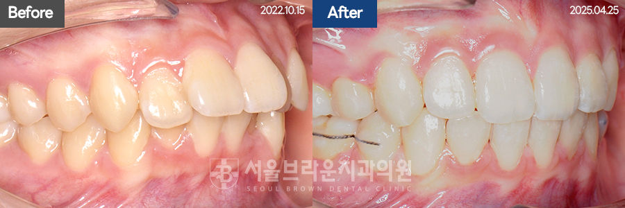 b05cd4bba924b3cd77aa7a17d37d707b_1768206