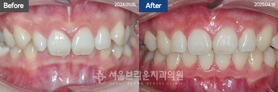 b05cd4bba924b3cd77aa7a17d37d707b_1768206